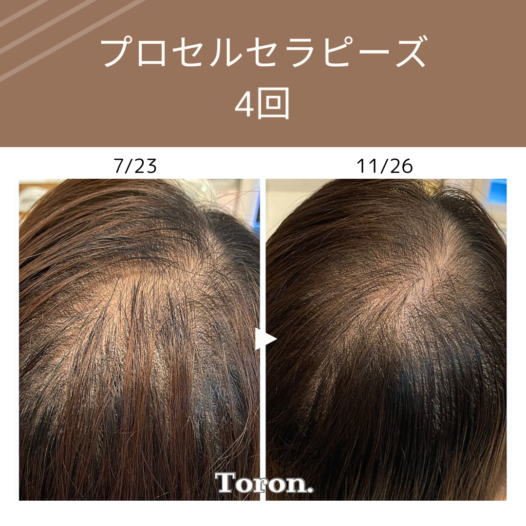 プロセルセラピーズ プロセルセラピーズ（頭皮・フェイシャル） | サロンドソラ